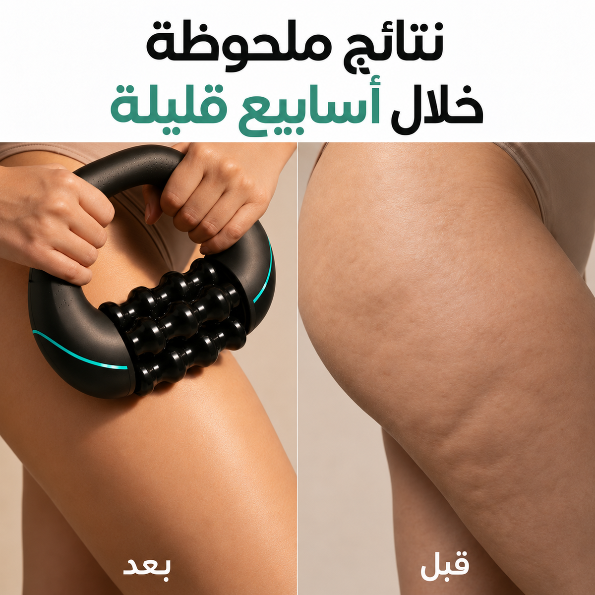 RollerMotion® — صورة المنتج بالعربية 4